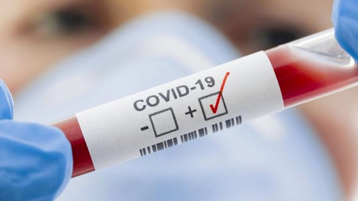 Число бессимптомных носителей COVID-19 в Казахстане стало 4892 человека