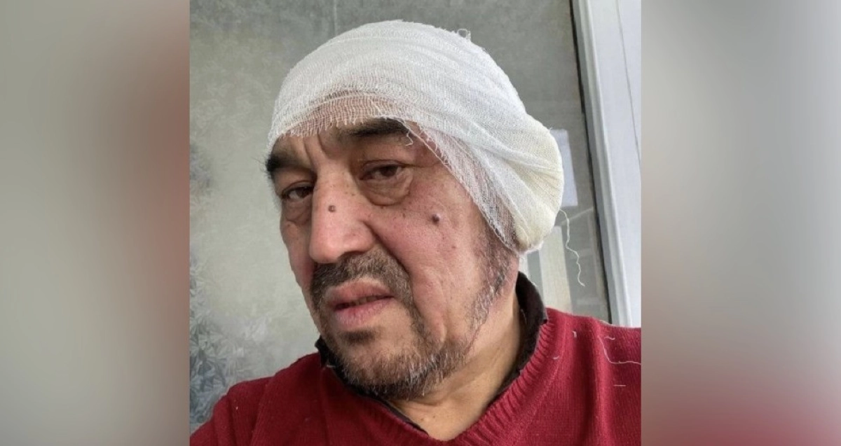 Екі құлағы үсіген: дәрігерлер видеодағы ер адамның денсаулығы туралы айтты (видео)