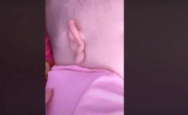 Ерекше қабілетті: құлағын өздігінен жауып алатын сәби елді таңғалдырды 