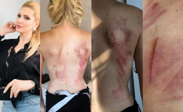 Прокурор запросил для обвиняемого в жестоком избиении бывшей супруги певицы Ксении Ашигалиевой 2,5 года заключения