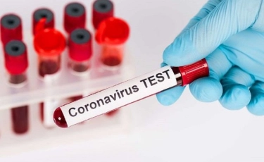Бас санитарлық дәрігер COVID-19  індетіне қатысты  тест тапсыру неліктен қымбат екенін түсіндірді