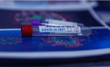 Уже 54 747: в Казахстане зарегистрировано еще 1726 случаев COVID-19