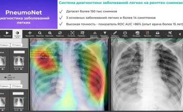 Алматыдағы аурухана мен емханаларда интеграцияланған жасанды интеллект қызмет түрі пайда болады