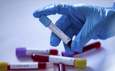 Барлығы 106 425: Қазақстанда өткен тәулікте тағы 64 адамнан коронавирус анықталды