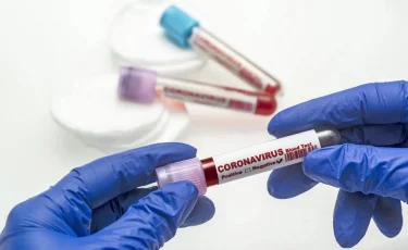 Ученые назвали новые симптомы коронавируса