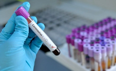 Әлемдегі COVID-19: жұқтырғандар саны 100 миллионнан асты  