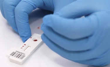 Қазақстандағы коронавирус: өткен тәулікте 658 адам індет жұқтырған