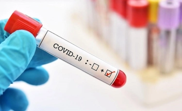 COVID-19 в Казахстане: продолжается рост количества заболевших за сутки
