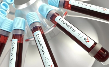 COVID-19 в Казахстане: Карагандинская область в лидерах по количеству зараженных за сутки