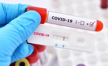 COVID-19 в Казахстане: продолжается рост количества зараженных за сутки 