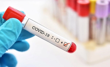 COVID-19 в Казахстане: резкое снижение количества зараженных за сутки 