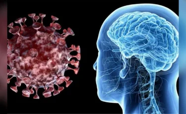 Объем мозга уменьшается у переболевших COVID-19 - ученые