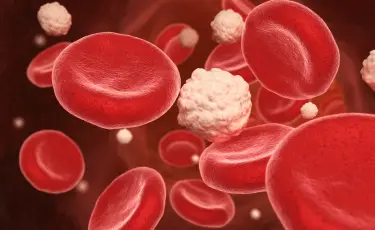 Кровь станет чистой: народное средство от холестерина