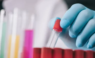 СҚО-да шошқа тұмауын жұқтырғандар тіркелді