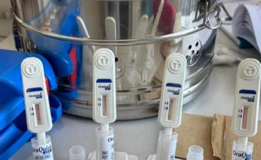 АИТВ-ның жұғу жолдары мен одан қорғану тәсілдері қандай