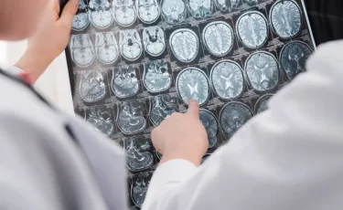 Ученые назвали группу крови, носители которой чаще бывают гениями