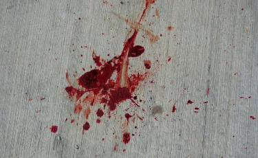 Алматы облысында ер адам әйелін ұрып, мұрнын сындырған