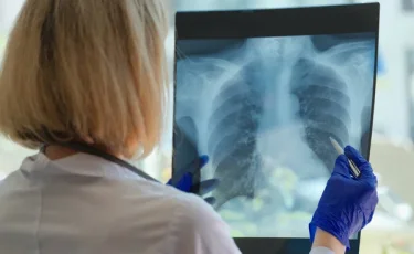 В Казахстане уровень заболеваемости туберкулезом снизился на 11%