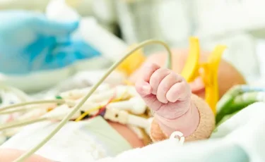 В Индии врачи спасли 350-граммовую девочку