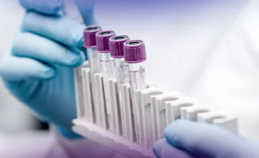 Тұмау вирусы: Алматыда эпидемиологиялық ахуал тұрақты