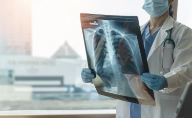 За пять лет смертность от рака в Казахстане снизилась на 20%