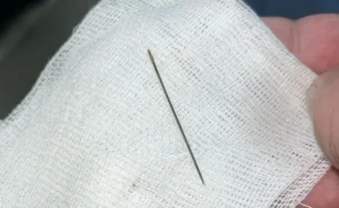 Түркістанда 8 айлық сәбидің ішінен ине табылды