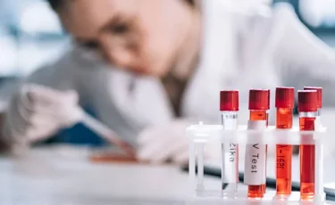 В Бангладеш умерла зараженная Нипахом женщина