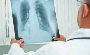 В Казахстане снизилась заболеваемость туберкулезом