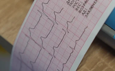 Соңғы жылдары елімізде 16 мың адамға инфаркт диагнозы қойылған