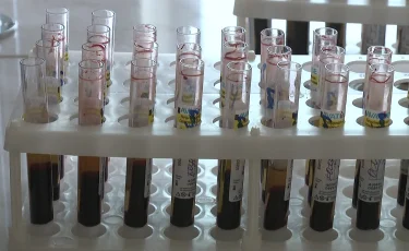 13 жастағы қызды зорлаған: Алматыда АИТВ жұқтырған ер адам күдікке ілінді