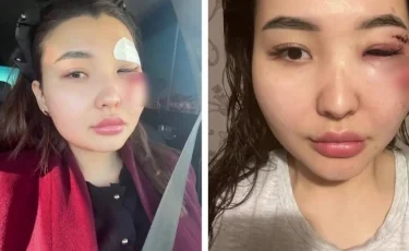 Соққыға жығылған атыраулық блогердің ісіне қатысты нүкте қойылды