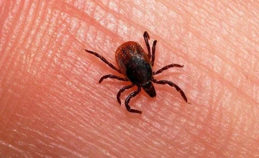 96 часов на спасение: что делать при укусе клеща и куда обращаться в Алматы