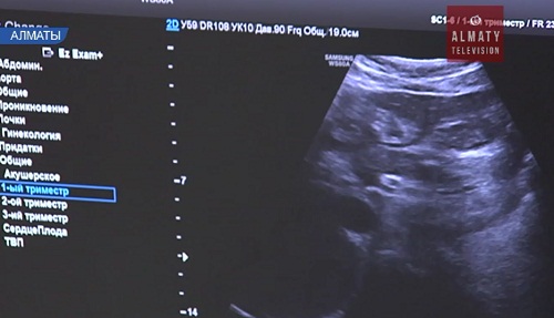 В Алматы внедряют новую методику исследования эмбрионов при ЭКО