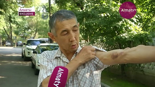 Алматыдағы ауруханалардың бірінде күзетшілер мүгедекті соққыға жыққан 