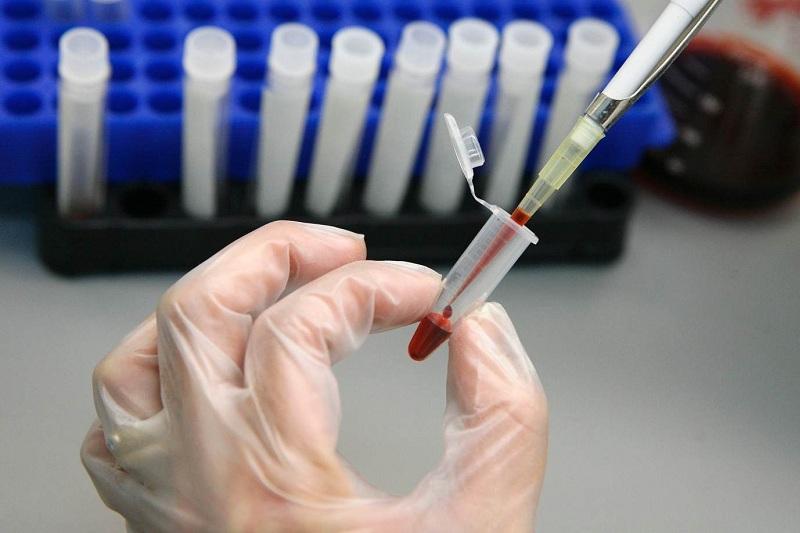 Заражение СПИДом нефтяников на Тенгизе опровергли специалисты