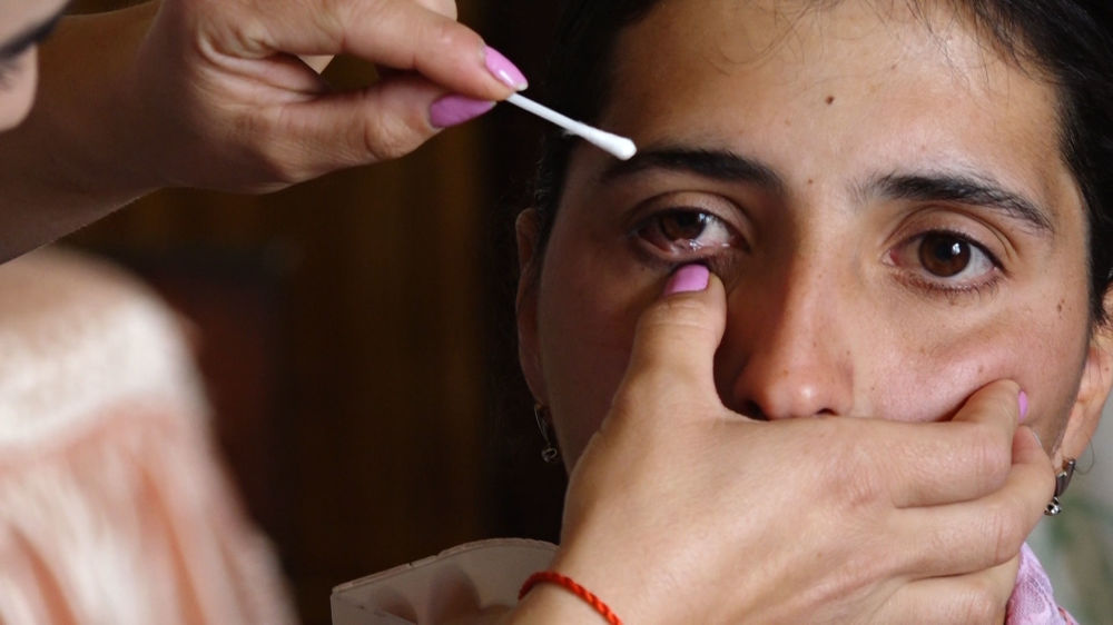 Кристаллы вместо слез: жительница Армении страдает необычной болезнью