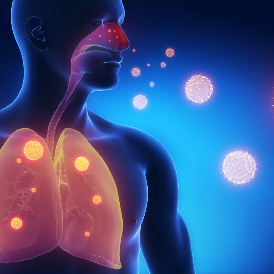 В Сиэтле подтвержден первый случай заболевания пневмонией из Китая