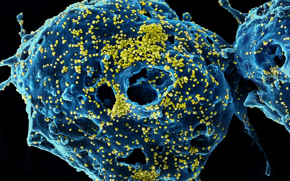 Угрожающие масштабы распространения коронавируса – обзор