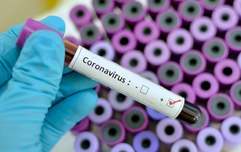 33 случай заболевания коронавирусом выявлен в Казахстане 