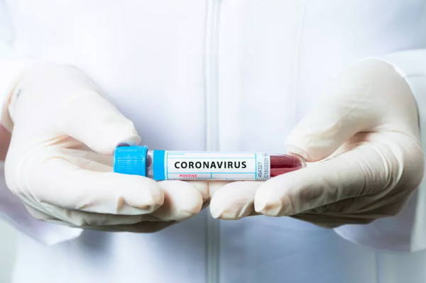 Число зараженных коронавирусом в Казахстане увеличилось до 79
