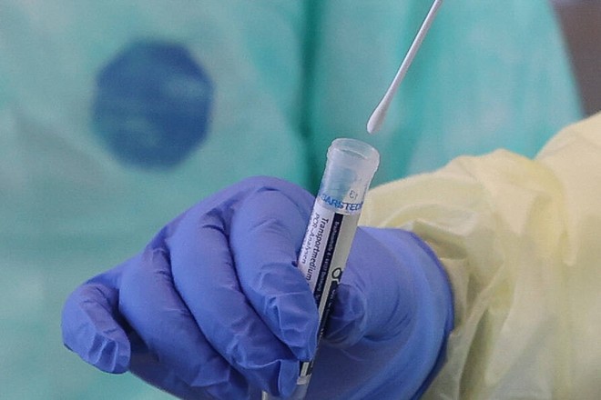 Алматы облысында коронавирус жұқтырған 4 науқас тіркелді