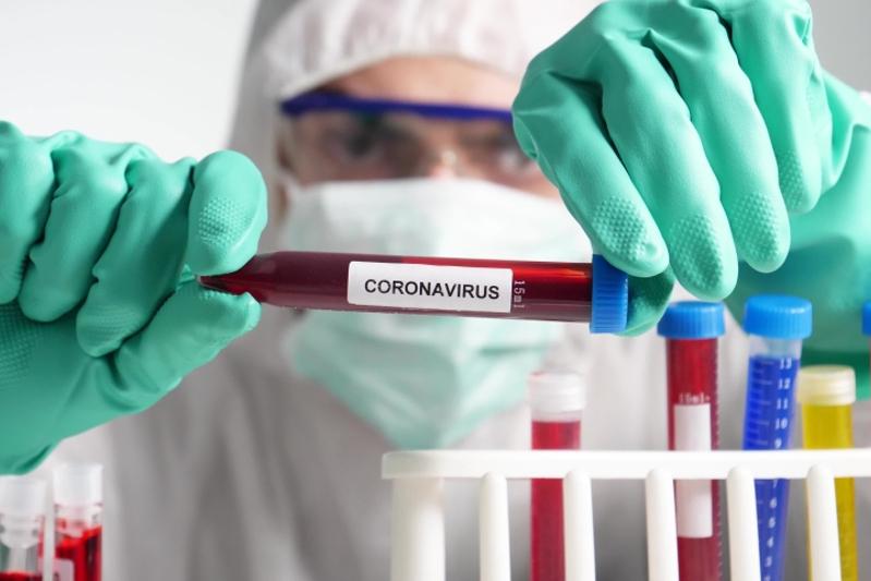 Шымкентте коронавирус жұқтырған 31 адам тіркелді