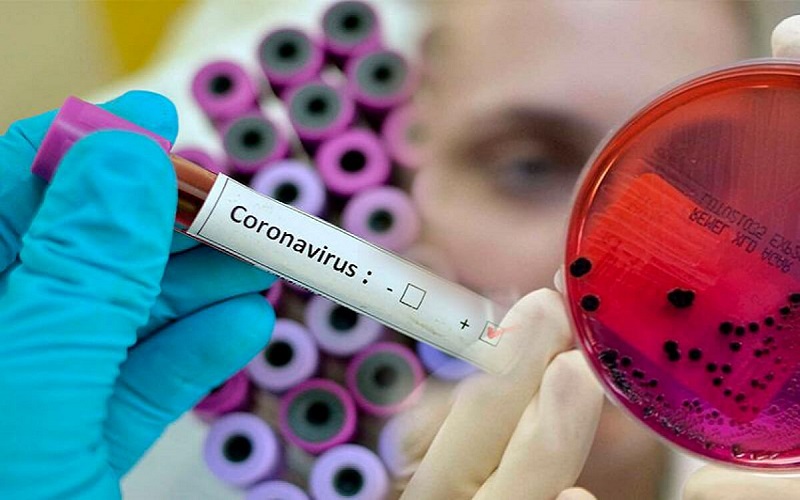 Шымкентте 34 адамнан коронавирус анықталды