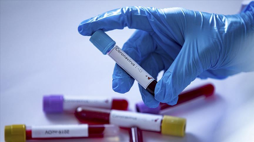 Қарағанды облысында коронавирус жұқтырған 34 адам тіркелді