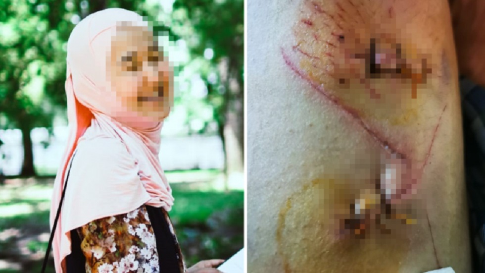 Чудом осталась жива: житель Алматы изрезал ножом бывшую жену и напал на няню