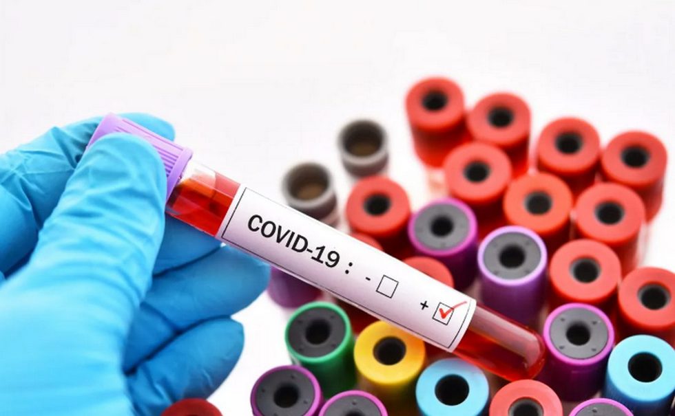 Всего 17 225: еще 446 случаев заражения коронавирусом зарегистрировано в Казахстане