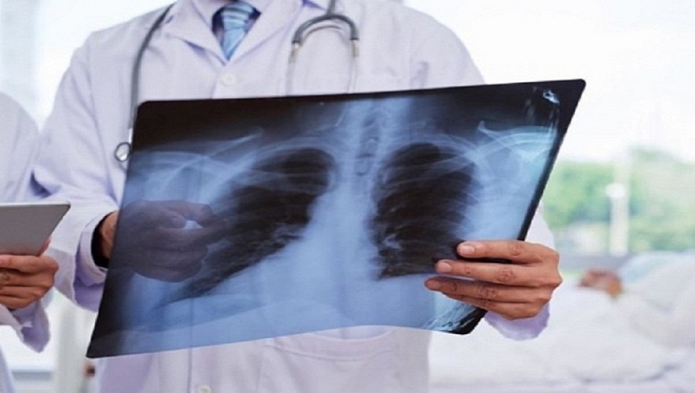 В Казахстане еще 16 человек скончались от пневмонии  