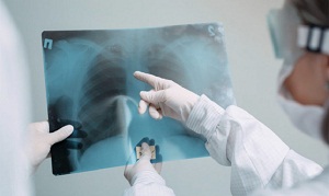 В Казахстане за прошедшие сутки 6 человек скончались от пневмонии
