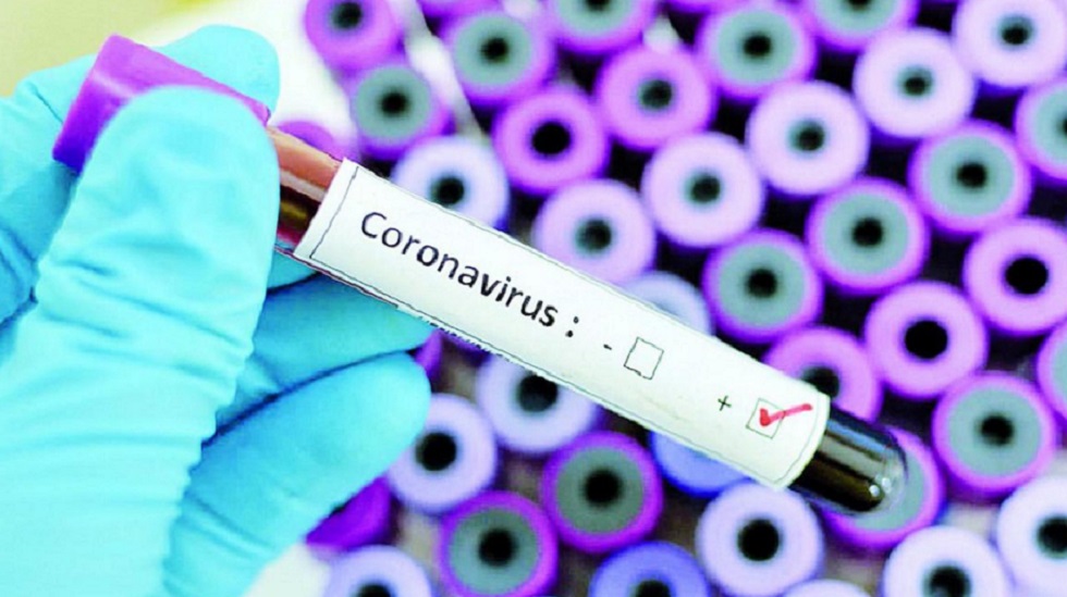 Барлығы 106 920: Қазақстанда өткен тәулікте тағы 65 адамнан коронавирус анықталды