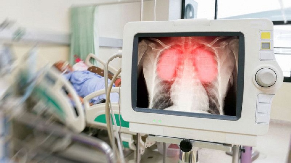Ещё 1 человек скончался от пневмонии в Казахстане